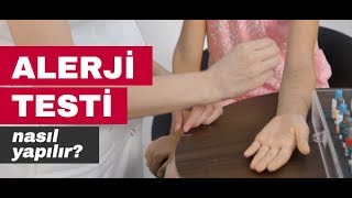 Alerji Testi Nasıl Yapılır  İstanbul Alerji [upl. by Yonina]