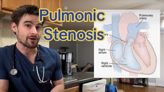 Pulmonic Stenosis in Pets [upl. by Caitlin]