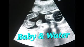 Pregnancy ultrasound  water around the baby  usg pregnant  liquor is adequate  second trimeter [upl. by Enilecram]