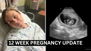 12 WEEK PREGNANCY UPDATE  IN THE ER  BLEEDING AT 12 WEEKS PREGNANT [upl. by Arabelle]