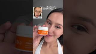 Snail Eye Cream’s Magic Transformed My Dark Circles [upl. by Aivon786]