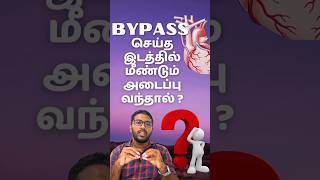 பைபாஸ் செய்த இடத்தில் அடைப்பு ஏற்பட்டால் bypass stenting ytshorts tamilhealthtips [upl. by Alley15]