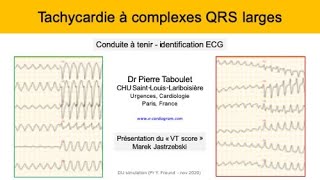 10d Tachycardie à QRS larges ECG Presentation du VT score Dr Taboulet [upl. by Lewison946]