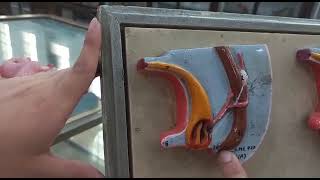 embryology model development of genitourinary system [upl. by Nealah]