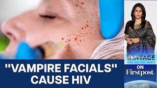 Three Women Infected with HIV After quotVampire Facialsquot US  Vantage with Palki Sharma [upl. by Eiramanad326]