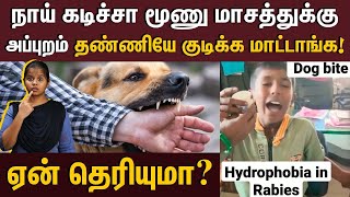 நாய் கடிச்சா நாய் மாதிரி குரைப்பாங்களா  Everything you should know about Rabies  Rabies symptoms [upl. by Ettenrahs]