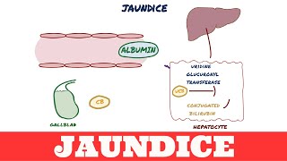 Jaundice [upl. by Annawyt]