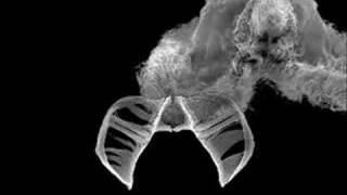 Rotifers from the bird bath with closeup SEM [upl. by Noyrb466]