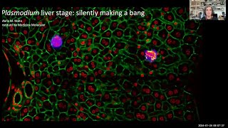 quotPlasmodium liver stage silently making a bangquot by Dr Maria Mota [upl. by Darcy]