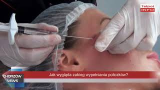 Jak się wypełnia policzki [upl. by Connell]