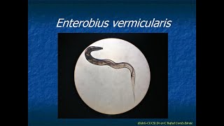 Enterobius vermicularis [upl. by Nyram]