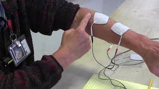 Stroke Rehabilitation Use of electrical stimulation to help arm and hand recovery [upl. by Eiramanel]