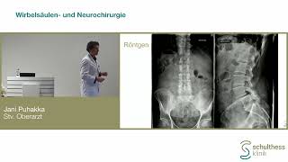 «Fallvorstellung  Hausarztfortbildung Wirbelsäule»  Schulthess Klinik [upl. by Wiener]