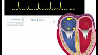 ACLS ECG Rhythm Review [upl. by Rafaelof]