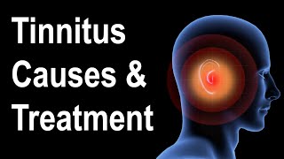 What is Tinnitus Causes amp Treatment Strategies [upl. by Spiros]