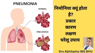 Pneumonia निमोनिया क्या है प्रकार कारण लक्षण और घरेलू उपाय। Hindi by  Drx Abhilasha IMS BHU [upl. by Wistrup]