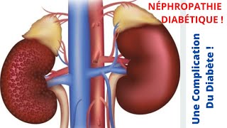 Une Des Complications Du Diabète  La Néphropathie Diabétique [upl. by Thay]