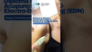 Online Diploma Course 60 HD Videos  ElectroAcupuncture amp ElectroDry Needling [upl. by Retep]