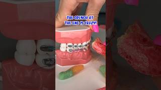 FREEZE DRIED CANDY VS BRACES 🥶 ORTHODONTIST REACTS 👀 WILL IT BREAK BRACES OFF ASMR CRUNCHY TEETH [upl. by Claudell]