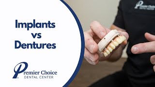 Implants vs Dentures Whats Best For You [upl. by Purdum]