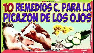 10 Remedios Caseros para el Picor de OjosComo tratar la Picazon en los Ojos [upl. by Enialed70]