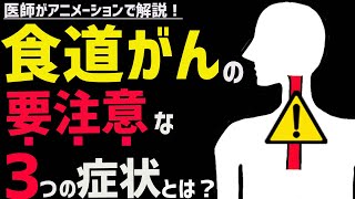 絶対に見逃してはならない食道がんの症状3選 [upl. by Ostler]