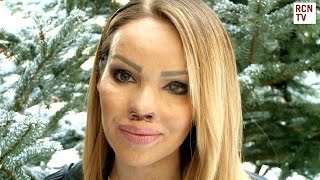 Katie Piper Interview  The Katie Piper Foundation amp Body Confidence [upl. by Ahsenom534]