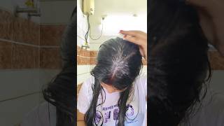 Scalp treatment Anti Dandruff shampoo shorts ytshorts youtube damdruff [upl. by Yona]