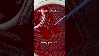 Moraxella catarrhalis Hocky Puck sign microbiology [upl. by Ellatsirhc]