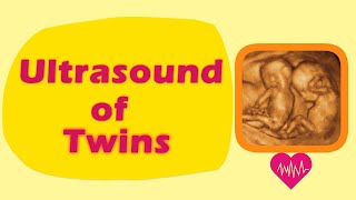 Sonography of Twins [upl. by Aram]