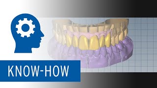 Simple Predictable Fast  Monolithic Esthetics with Zolid FX Multilayer Zirconia [upl. by Matelda]