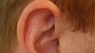 Determine If Ear Cartilage Is Infected  Ear Problems [upl. by Nylidnarb915]