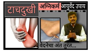 HEEL PAIN I टाचदुखी का होते I PLANTER FASCITIS I आयुर्वेद उपचार [upl. by Cookie]