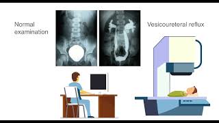 The CARE foundation  Ultrasound cystography [upl. by Dorrehs]