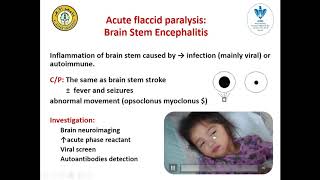 acute flaccid paralysis in children [upl. by Seymour345]