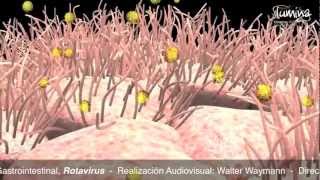 Infección Gastrointestinal por Rotavirus [upl. by Tsugua]