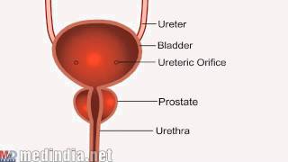 What Is Chyluria [upl. by Aral577]