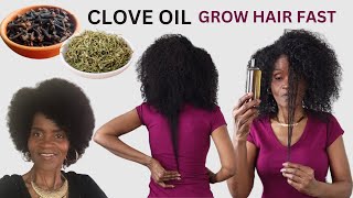 RIGHT WAY TO MAKE CLOVE OIL FOR FAST HAIR GROWTH  USE THIS TWICE A WEEK  STOP HAIR FALL [upl. by Fenella]