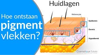 PIGMENTVLEKKEN  Hoe ontstaan pigmentvlekken  Wat zijn pigmentvlekken [upl. by Laenahtan]