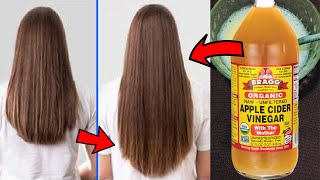 Apple Cider Vinegar For Hair Growth apple Cider Vinegar And Egg Hair Mask get Long Thick Hair [upl. by Rayna]