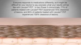 Levulan Patient Education Video [upl. by Eirrab3]