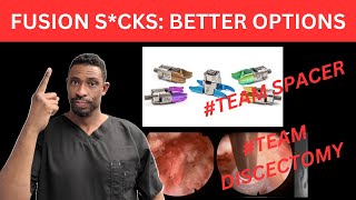 Why Spinal Fusion Sucks  Should you choose Team Spacer or Team Discectomy [upl. by Annitsirhc18]