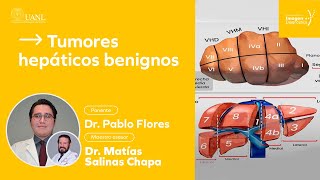 Tumores hepáticos benignos por el Dr Pablo Flores [upl. by Aihseket152]