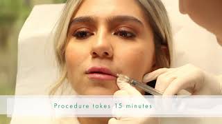 Injecting Lip Filler Juvederm Ultra with Dr Boen [upl. by Ahsercel]