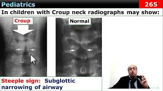 internalmedicine cme usmle محاضراتباطنة ecg كورساتباطنة clinical clinical medicine [upl. by Vastah]