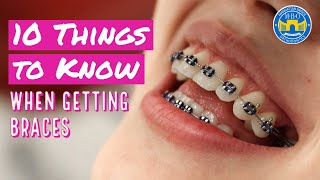 10 Things to Know When Getting Braces [upl. by Fillender]