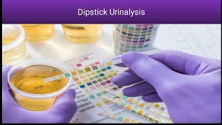 Dipstick Urinalysis Know about complete Dipstick Urinalysis  Rapid Urine Test [upl. by Norvun326]