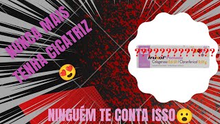 VLOG POMADA IRUXOL  colagenase e cloranfenicol [upl. by Shanney]