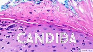 Candida Yeast Infection under microscope Candidiasis Dermatology Dermatopathology [upl. by Harl]