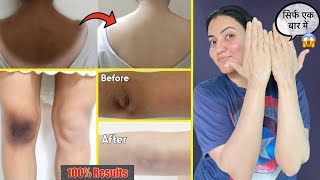 Dark Neck Elbow Knee Back Full Body Tan कालेपन को जड़ से खत्म करें सिर्फ 1 बार में ❤️ [upl. by Ihsar374]